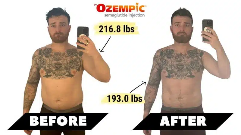 Ozempic before and After